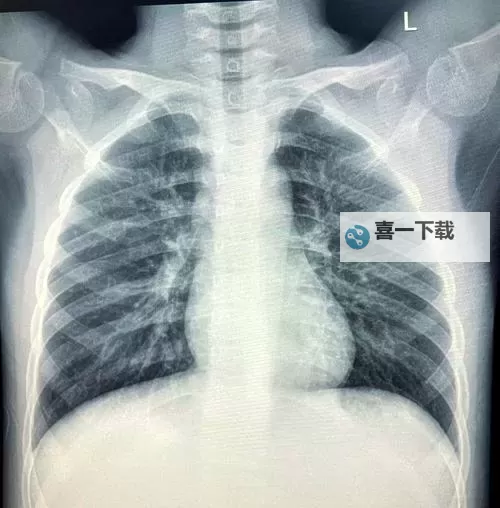 【最新整理】胸片曝光免费观看大全，全面免费在线看！图1