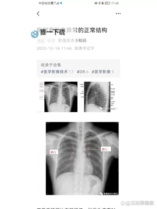 2023最新曝光：胸片曝光没有衣服事件引发热议图1