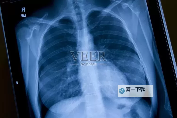 100%胸片曝光率可以直接看免费无病毒，保障您的健康安全图1