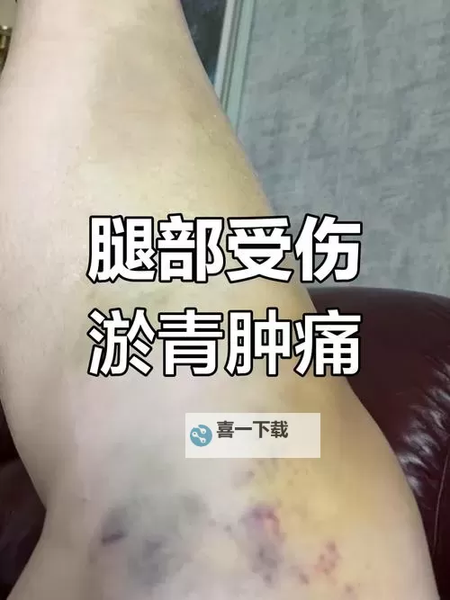 紫黑色肿大横冲直撞:夜幕中的神秘危机图1