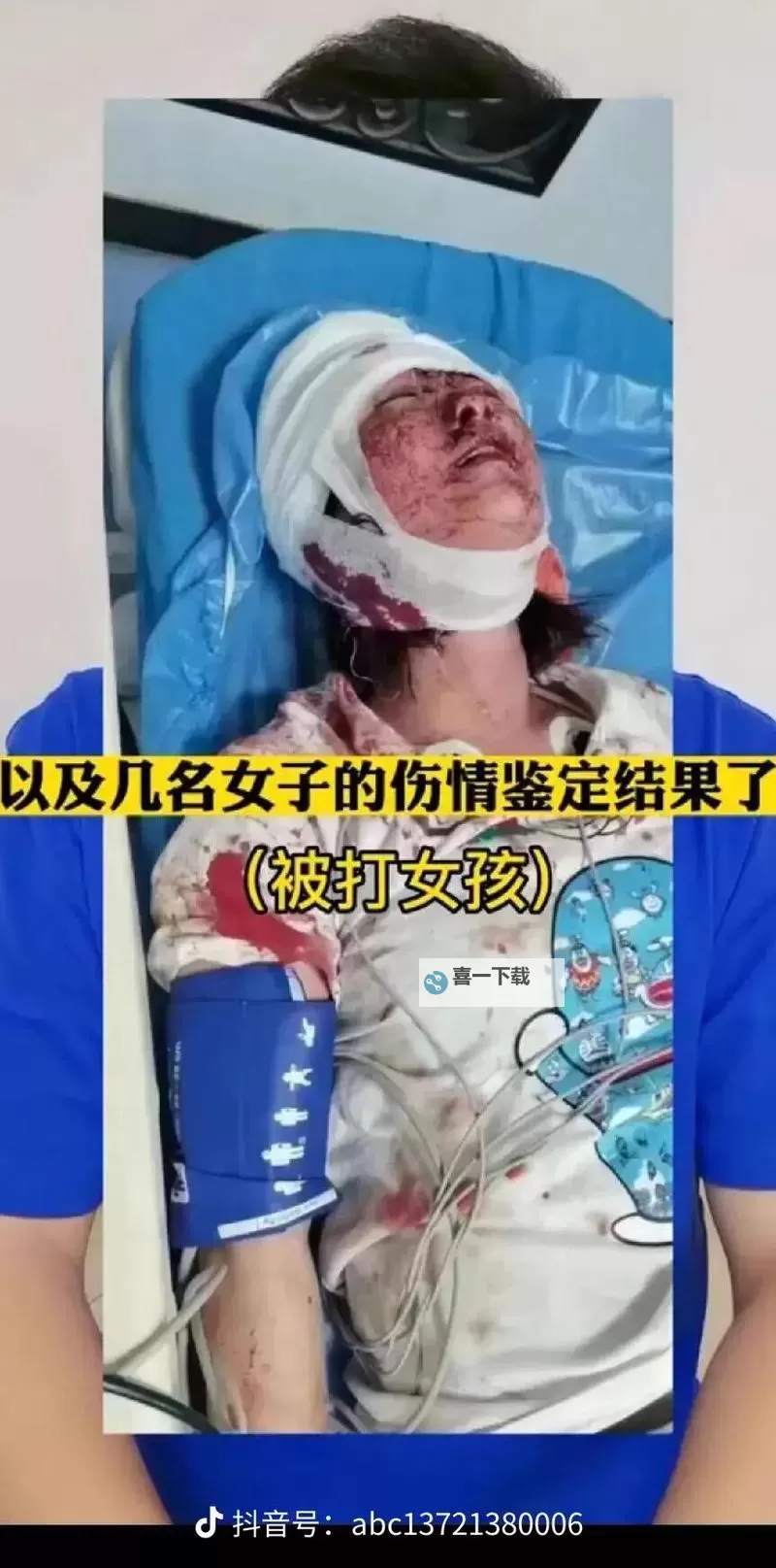 昨天唐山发生一起命案：事件详情与社会反响图1