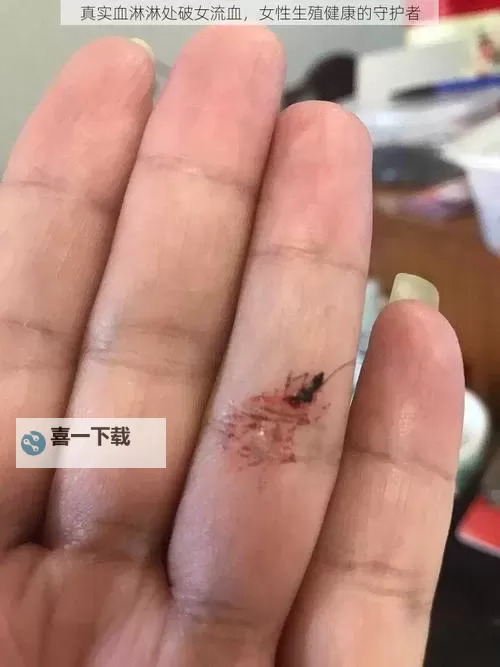 真实破外女摘花流血了:惊心动魄的瞬间揭秘图1