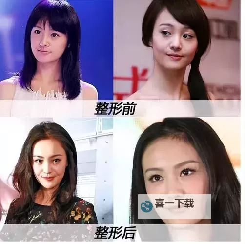 郑爽承认整容视频曝光：真相令人震惊图1